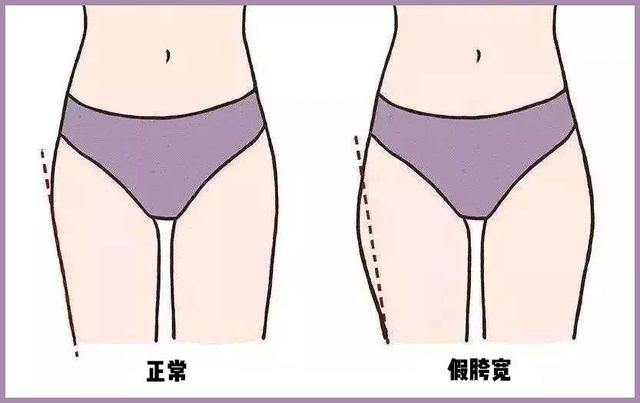 胯宽、屁股大的女生,穿这3件衣服,显胖又显土