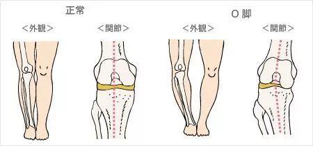 你的双腿合得拢吗?女人的双腿分得越开,说明..…