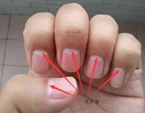 “生育能力”强的女人,这3个部位会比较突出,快来自测一下