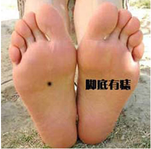 男生十大福气痣的图片,男人满脸上的痣好不好