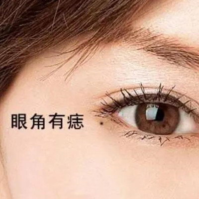 左眼眼尾痣代表什么，左眼上眼皮一直跳是预示什么