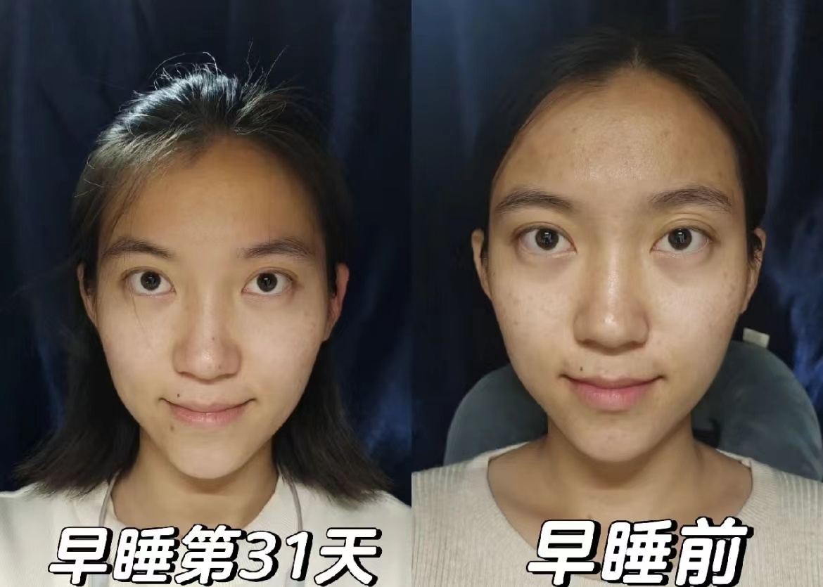 女子晒连续早睡变化