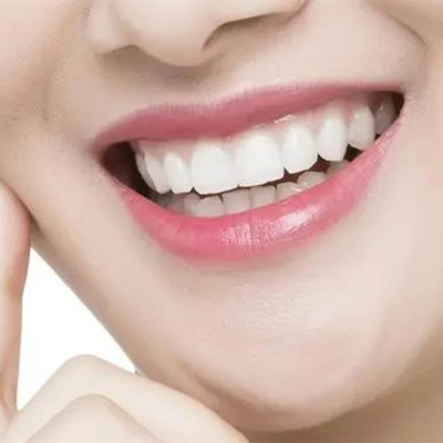 30岁为什么不建议箍牙