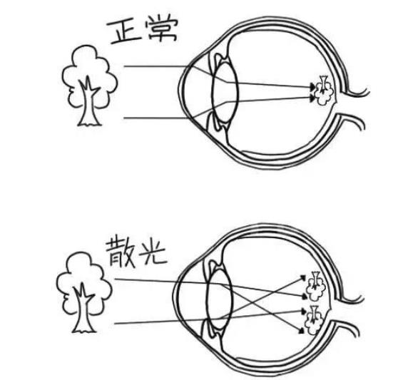 一张图测测你散光的度数
