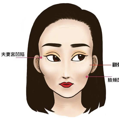 夫妻宫凹陷代表什么