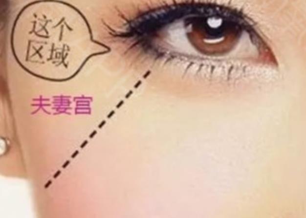 图解夫妻宫位置