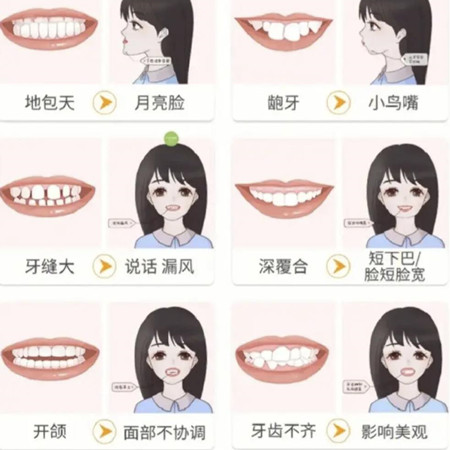 整牙的最佳年龄