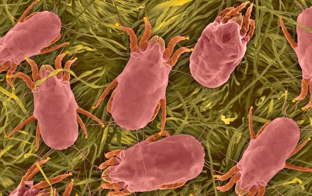 床上皮肤有螨虫的症状图00