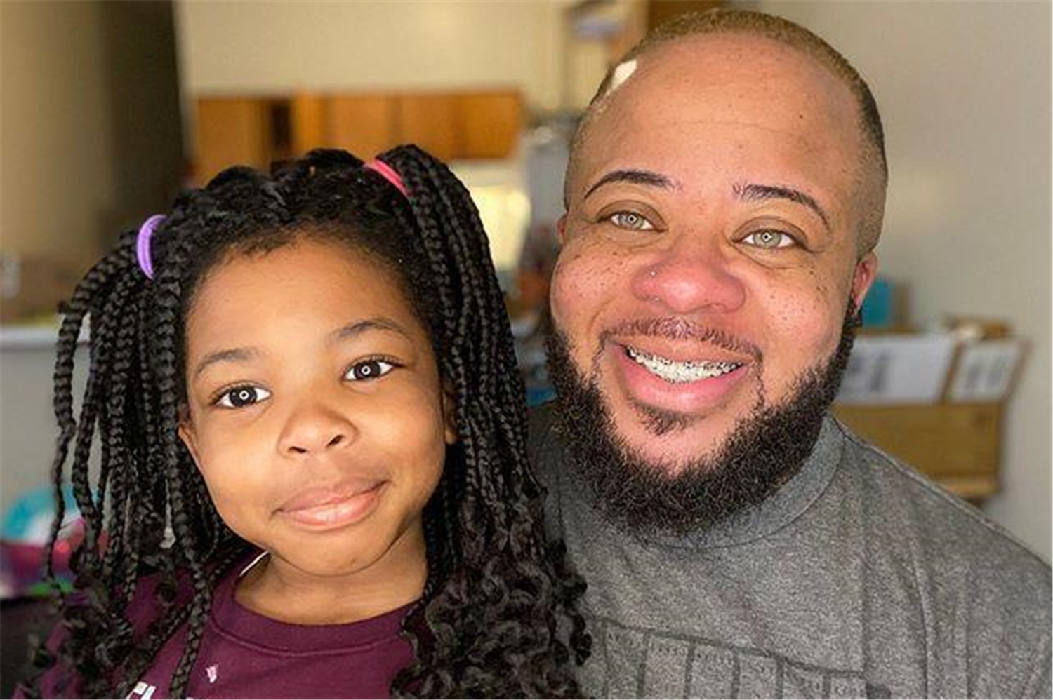 为什么络腮胡的男人生女儿多,长络腮胡说明男人什么