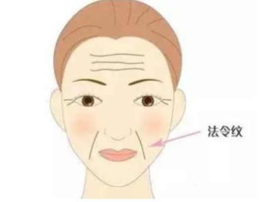 二十岁为什么有法令纹，二十岁就有法令纹正常吗
