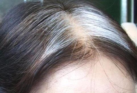 身体哪三处长白发不好，三处地方长出白发要警惕