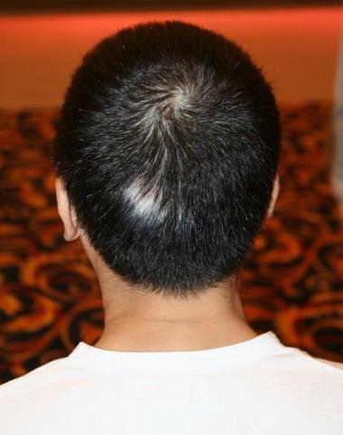 身体哪三处长白发不好，三处地方长出白发要警惕