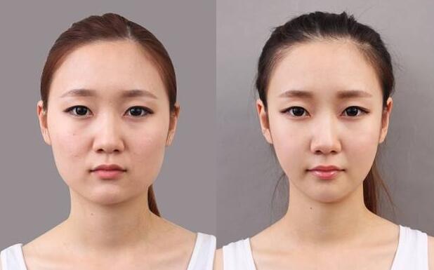 女人倒立一年脸部变化图,女人倒立一个月脸部变化对比图-528时尚网