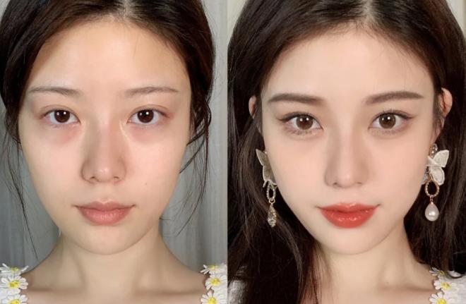眼袋和卧蚕的区别的图片,眼袋和卧蚕是一回事吗