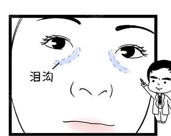 男人泪沟明显代表什么，女孩泪沟深说明了什么