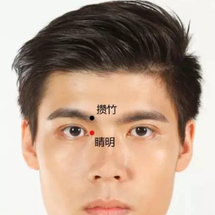 睛明穴位的准确位置图