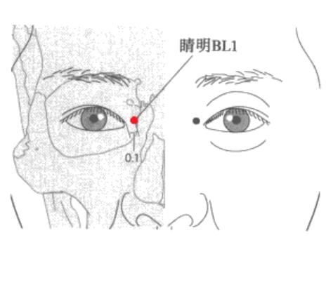 睛明穴位的准确位置图