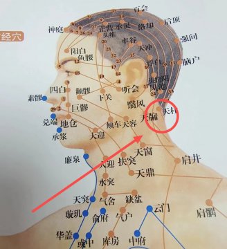 头部穴位图解大全图，头部穴位图精确图