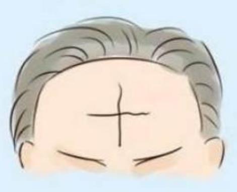 额头纹路命运图片大全