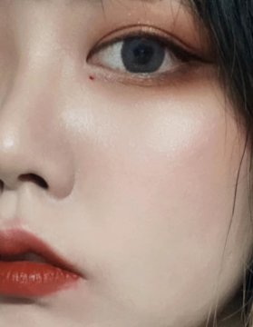 朱砂痣真实长相图片，脸上朱砂痣真实图片