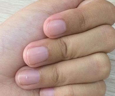 爱咬指甲什么原因,如何改善咬指甲的行为