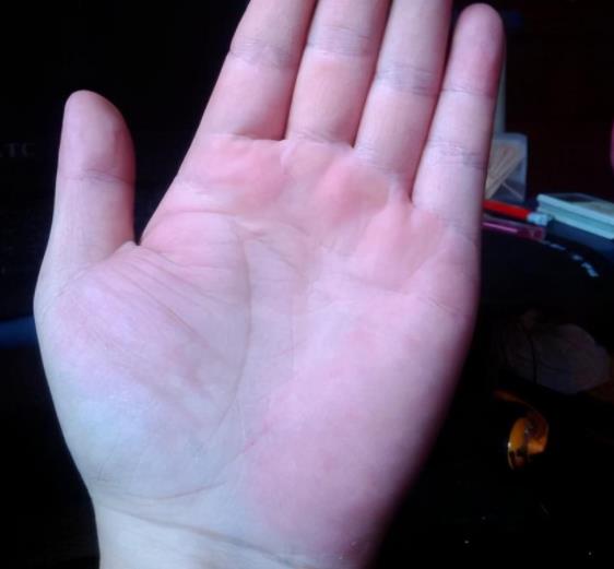 晚年大富大贵的三条纹,中年大富大贵的三种纹