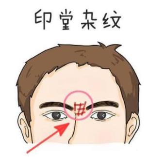 眉心有竖纹是天眼吗,眉心有二条竖纹的说法