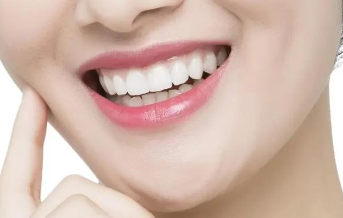 30岁为什么不建议箍牙