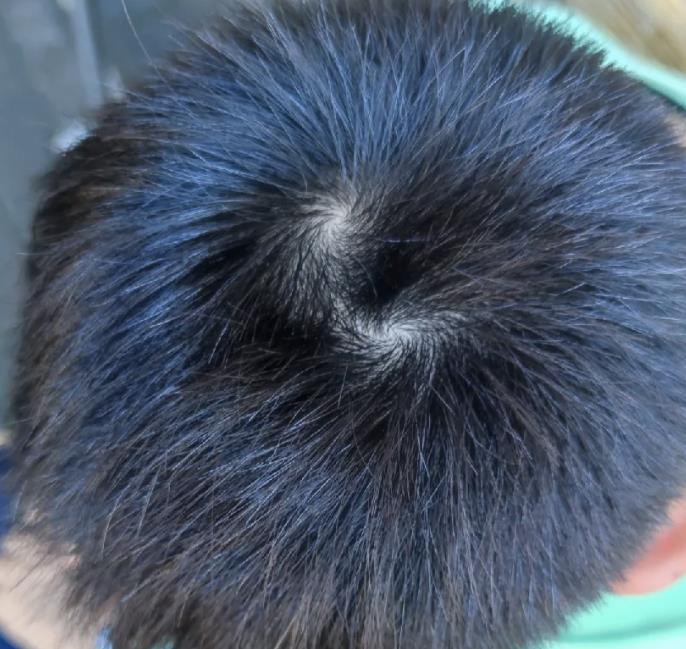 男孩头顶两个旋代表什么,两个旋的男孩好不好