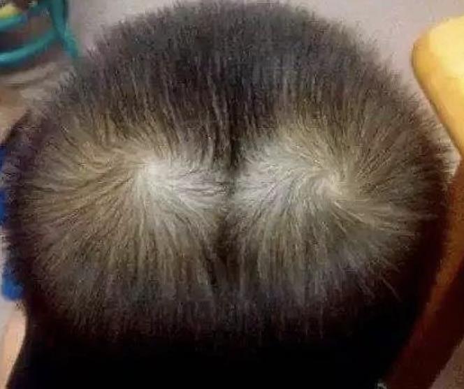 男孩头顶两个旋代表什么,两个旋的男孩好不好