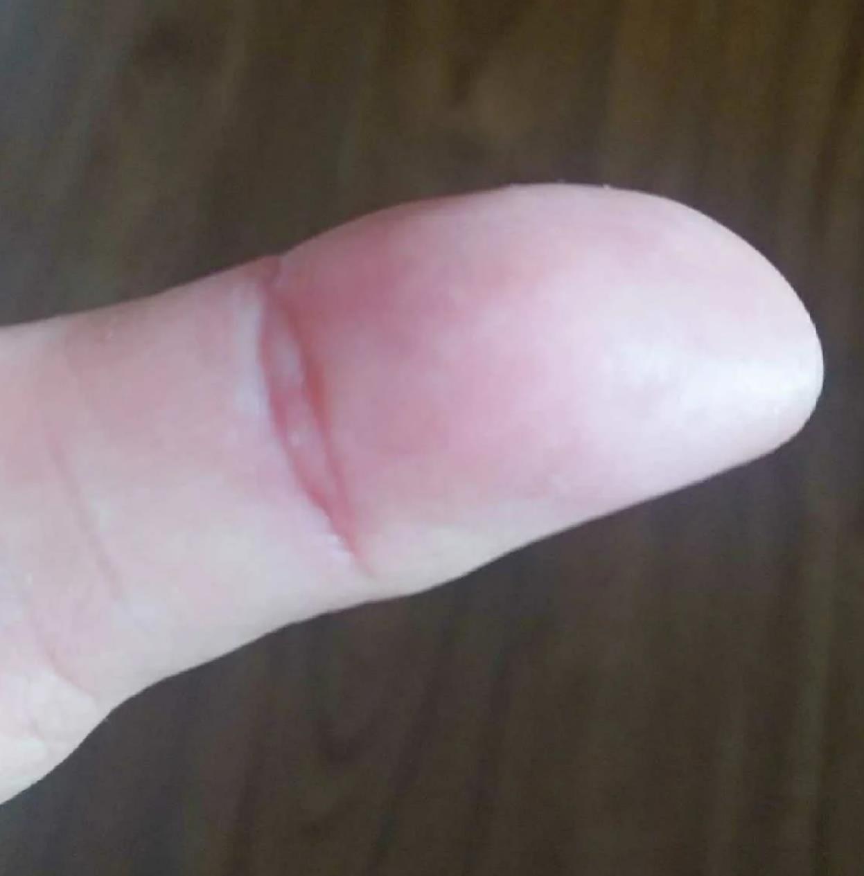 夫子眼的女人命运如何,娶到就要懂得珍惜