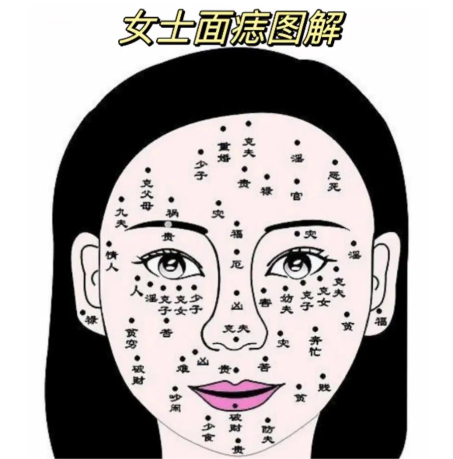 女人痣的解释图，脸上痣的解释图