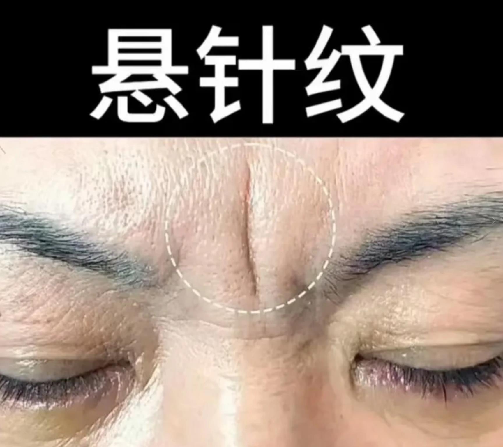 额头悬针纹图片