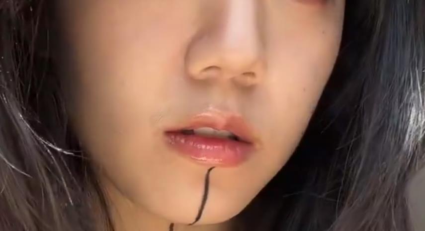 下巴虾线是什么