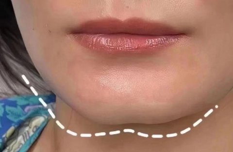 下巴有个沟的女人面相