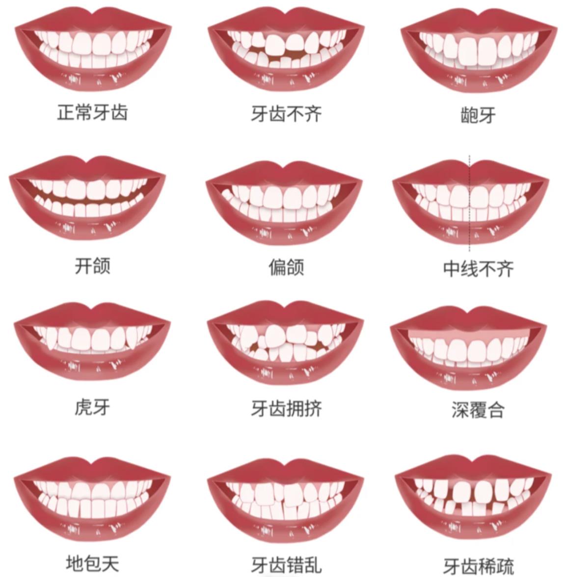 整牙的最佳年龄