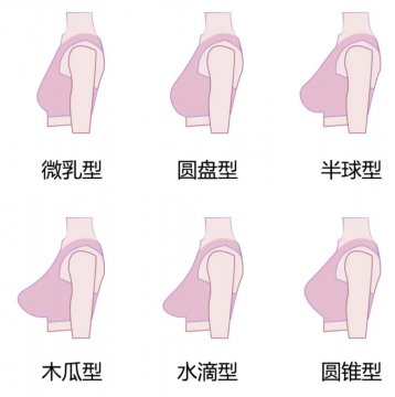 胸部挺拔度图示