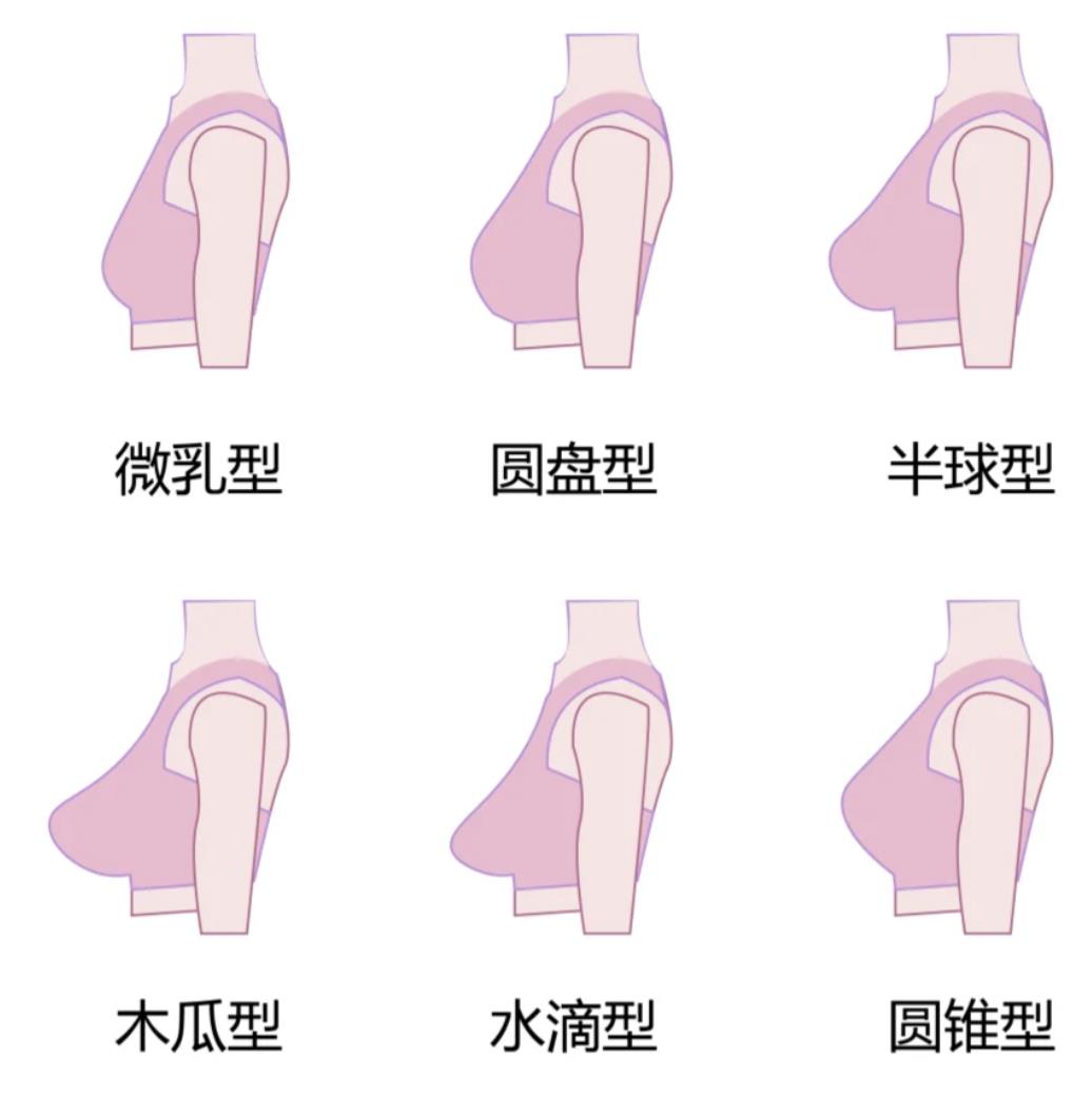胸部挺拔度图示