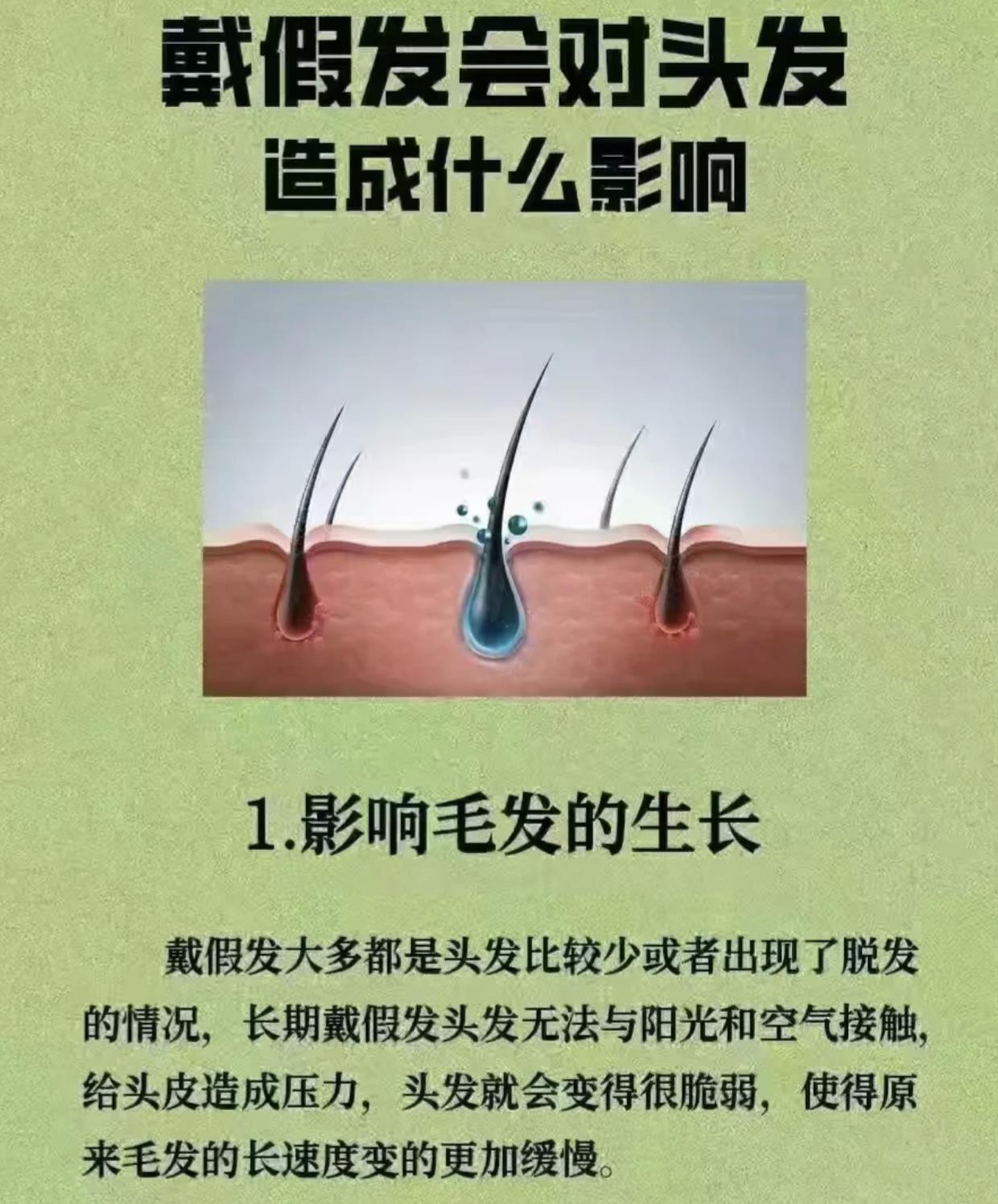 为什么不建议戴假发