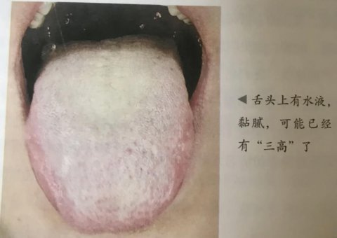 血糖高不高看舌头就知道