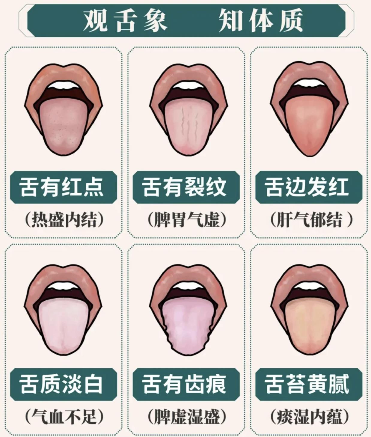 三十六种舌头图解