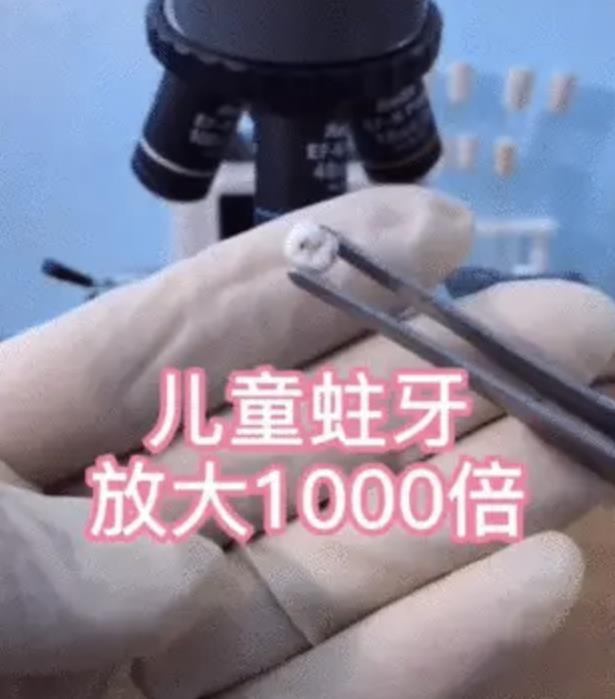 蛀牙放大1000倍的样子