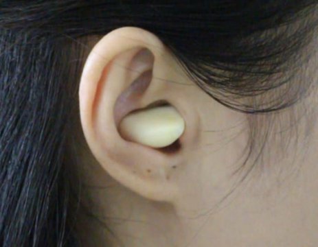 耳朵放大蒜有什么功效