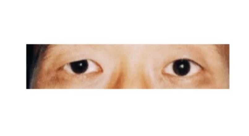 四白眼是啥样的为啥可怕