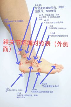 脚部疼痛位置图