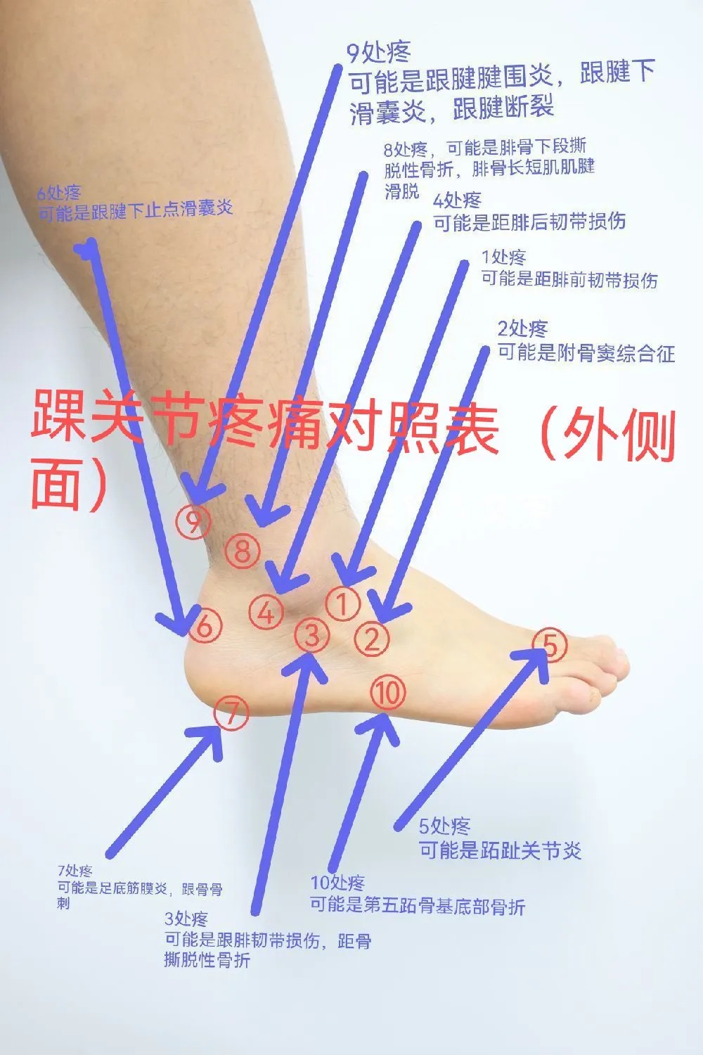 脚部疼痛位置图
