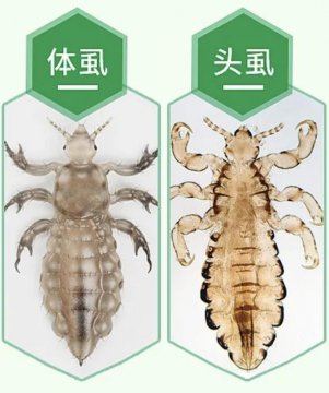 虱子是怎么产生的