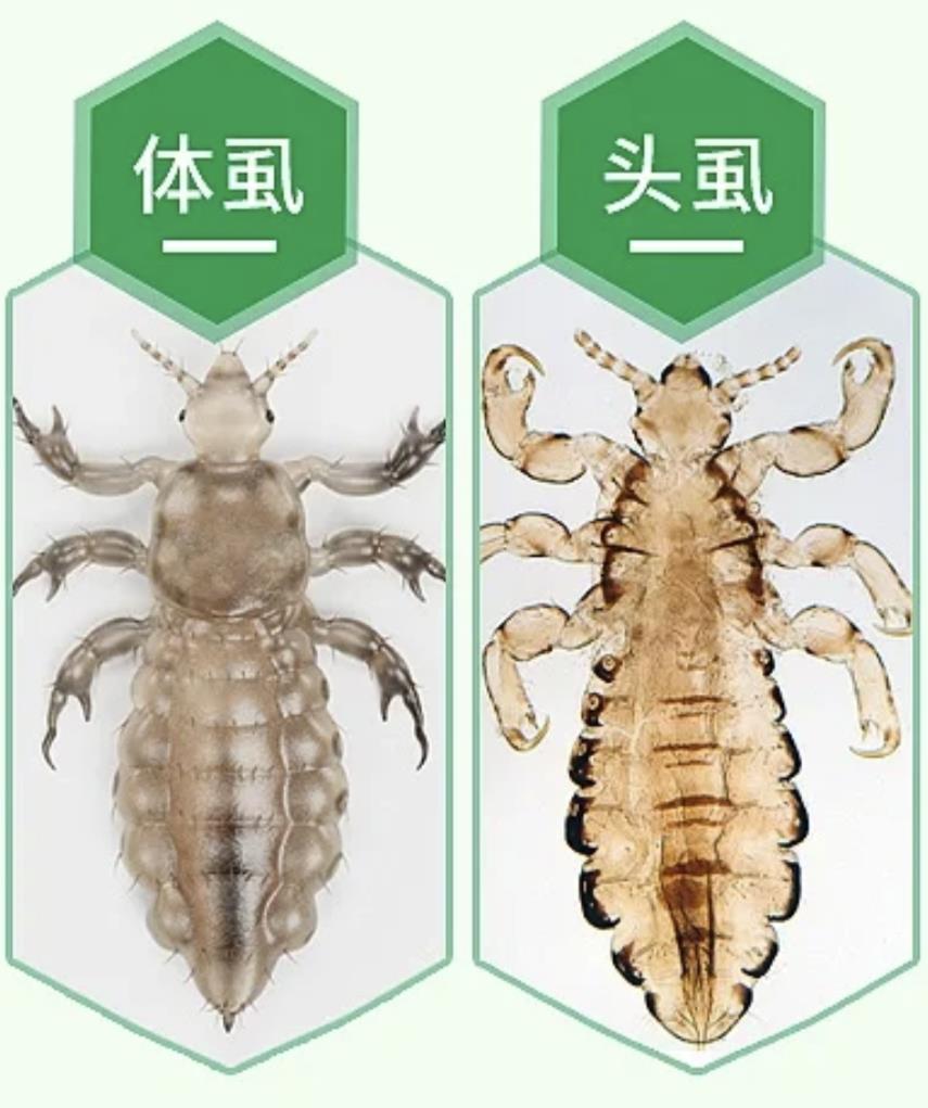 虱子是怎么产生的