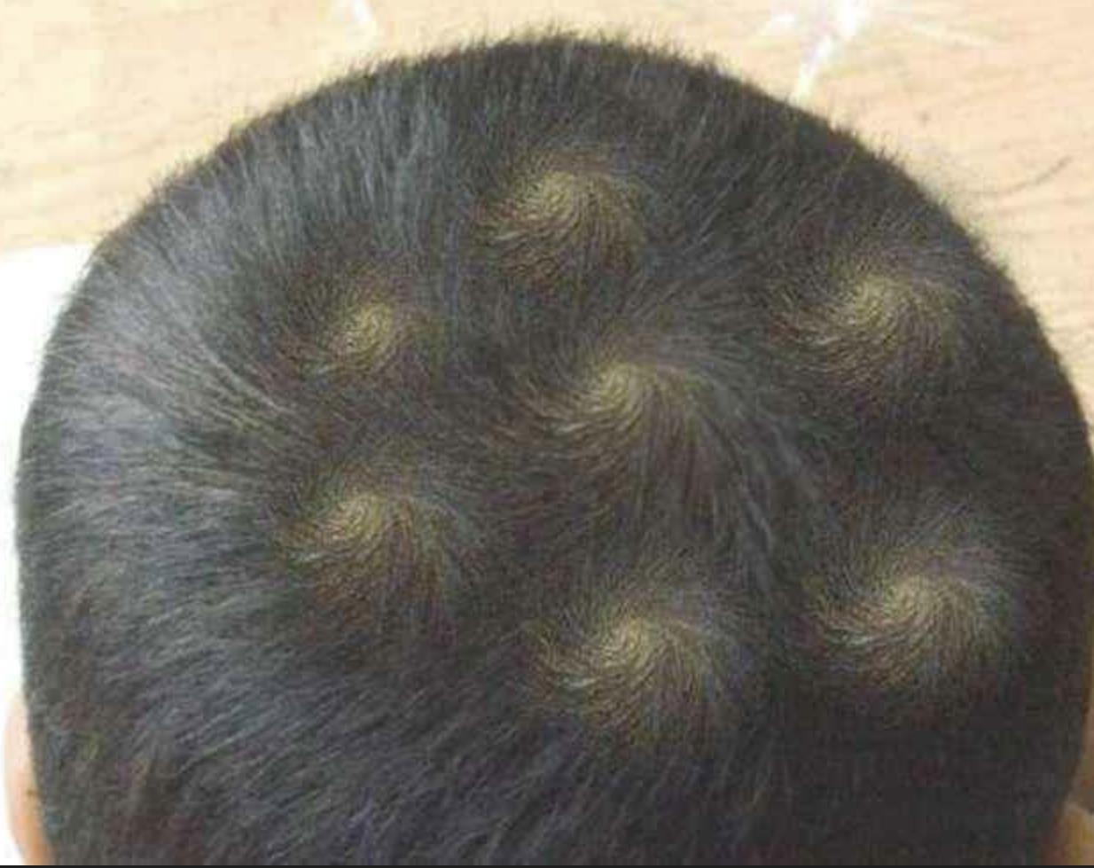 满头旋的孩子有什么说法