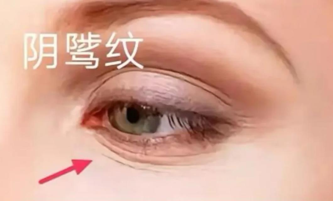 阴骘纹是什么样的